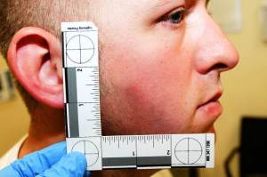 A series of photos show officer Darren Wilson's injuries following his encounter with Michael Brown. The almost-invisible swellings and red marks pale in comparison to the gunshot wounds that tore apart Brown's body.